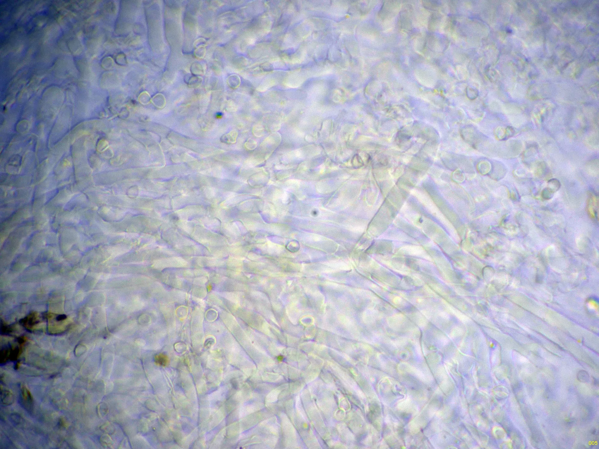 Microscopía de Tretomyces lutescens - 10 - Hifas Melzer-005